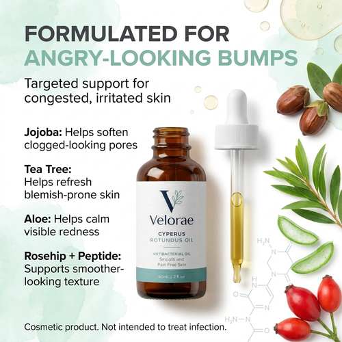 Velorae Cyperus Rotundus Antibacterial Oil